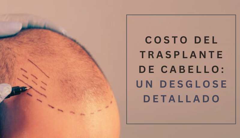 cuanto cuesta implante de cabello